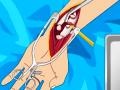 Ойын Arm surgery 2