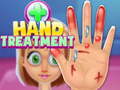 Ойын Hand Treatment
