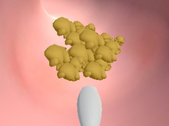 Ойын Earwax Clinic